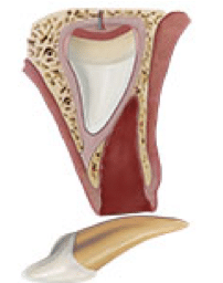 Esquema anatómico avulsión dental